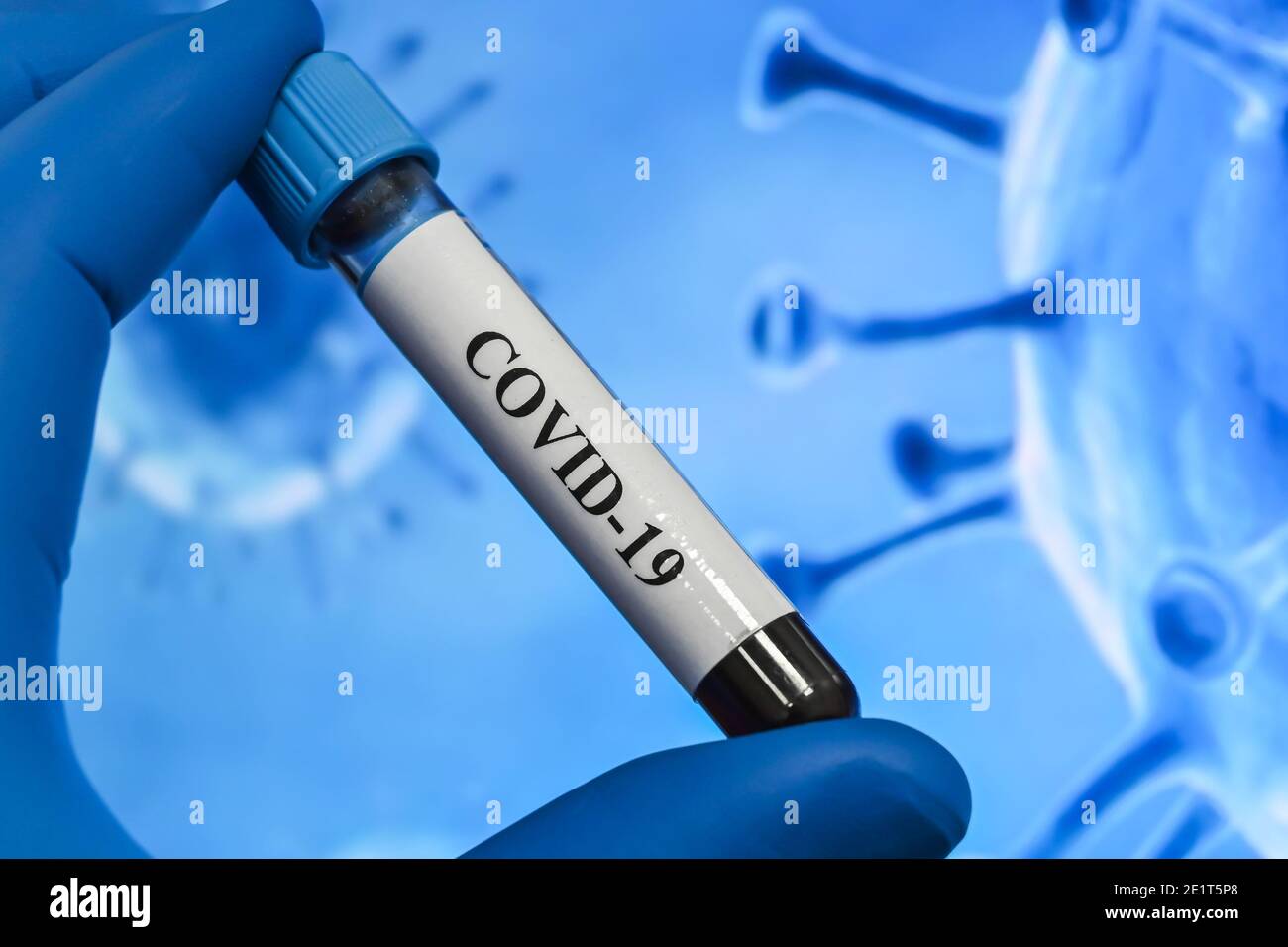 Coronavirus-Test. Nachweis von Antikörpern gegen COVID-19 in einer Blutprobe. Stockfoto