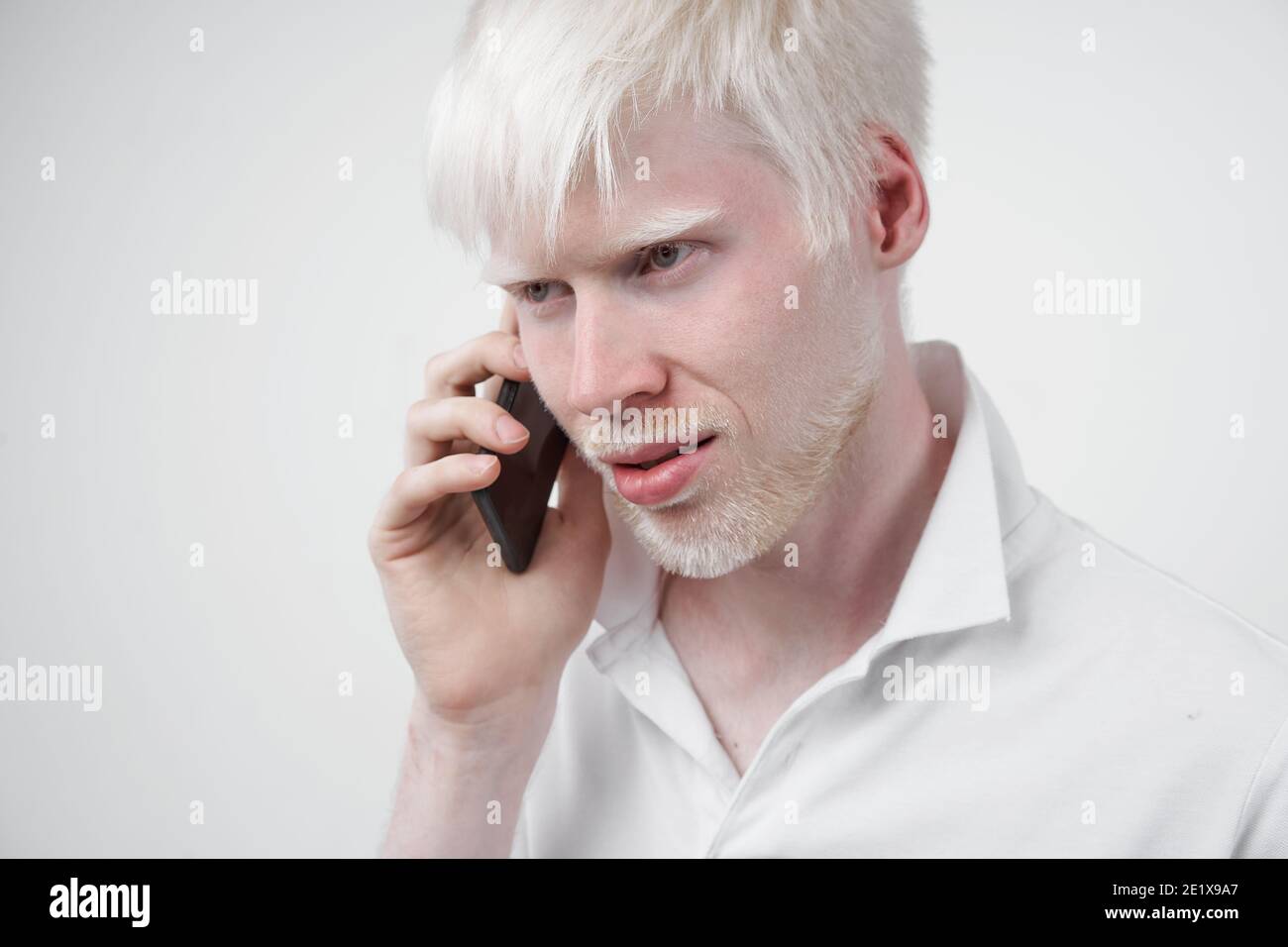 Albinismus Albino Mann weiße Haut Haar Studio gekleidet T-Shirt isoliert Weißer Hintergrund abnorme Abweichungen ungewöhnliches Aussehen Abnormität schöne Peop Stockfoto