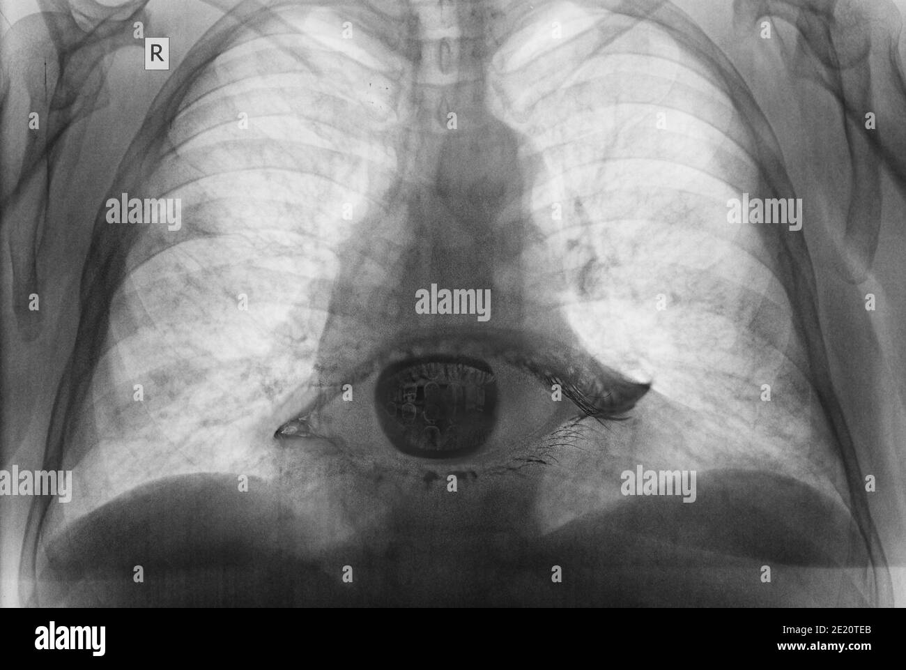 Abstraktes Bild des dritten Auges kombiniert mit einem Röntgenbild der Brust als Ausdruck, ein Zeichen der menschlichen Seele Stockfoto