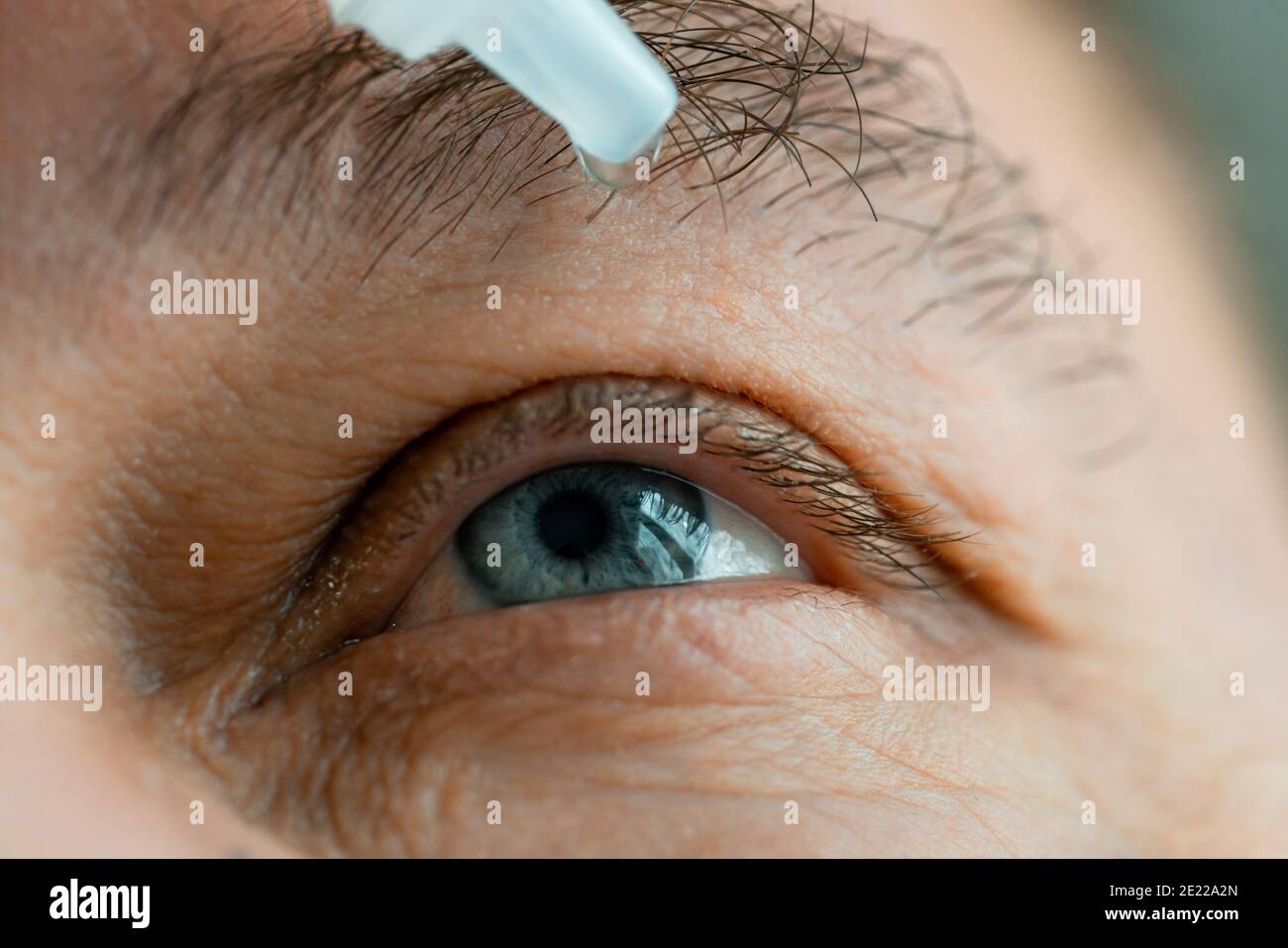 Ein Mann legt Augentropfen in seine Augen, bevor er Kontaktlinsen aufsetzt. Probleme mit der Lösungsvision. Stockfoto