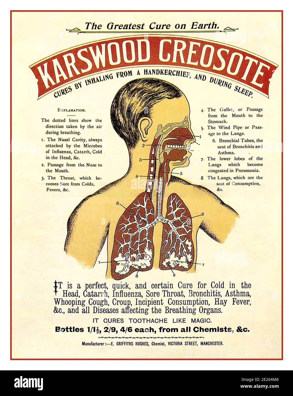 Vintage 1900 Werbeplakat für "Karswood Creosote" . Eine Werbung für ein „Wunder“-Arzneimittel. Aus Kreosot hergestellte Medikamente waren rezeptfrei für den häuslichen Gebrauch erhältlich, und sobald diese Medizin Karswood-Kreosot war, wurde sie um 1895 eingeführt. Als es herauskam, wurde es als neues Sweetwood Kreosot, für das Einatmen von einem Taschentuch beworben. Wenn Sie unter Cold in the Head leiden, versuchen Sie eine Flasche: Es wird Sie sofort entlasten. Eine perfekte Heilung für Husten, Bronchitis, Asthma, Keuchhusten, cruups, Nasal Catarrh [verstopfte Nase] usw. Stockfoto