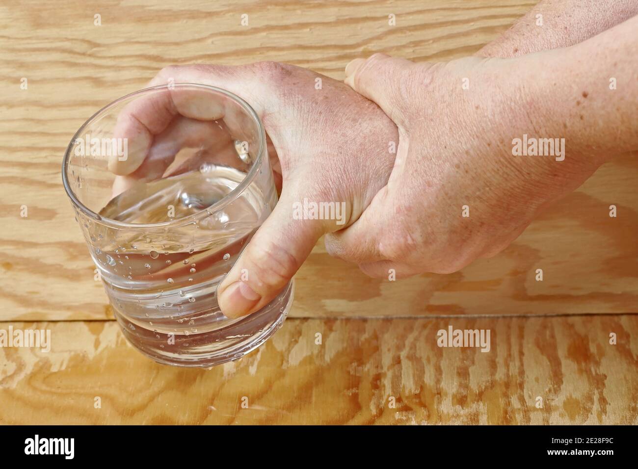 Eine Frau mit Parkinson schüttelt ihre Hände so stark, dass sie kein Glas mehr halten kann. Stark zitternde Hände einer älteren Frau Stockfoto