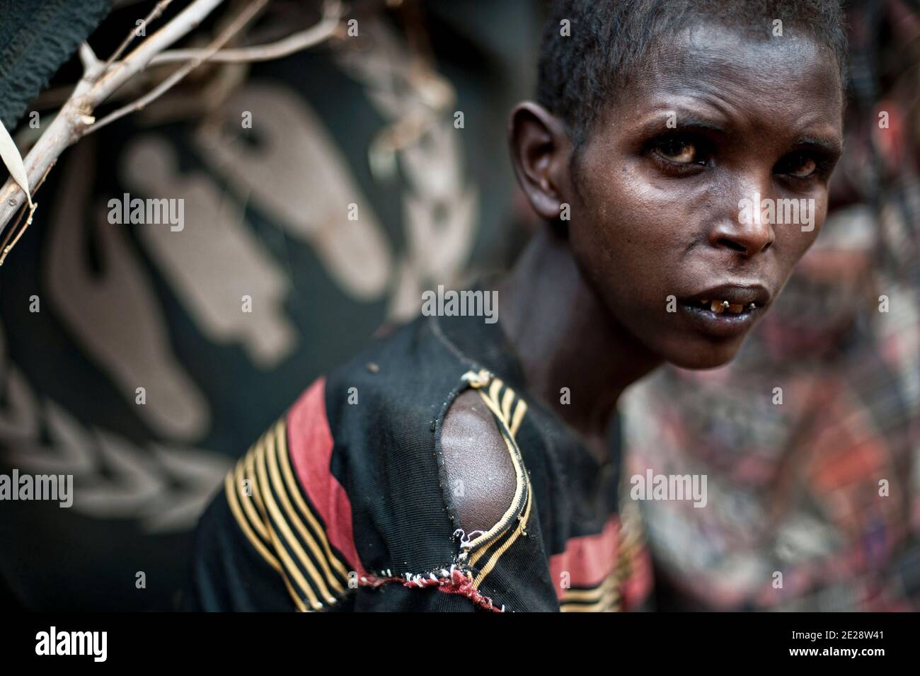 Ibrahim Aden, 20 Jahre alt, am 12. August 2011 im Flüchtlingslager Dadaab in Kenia abgebildet. Er lebte in Dinsoor, einer Stadt im Südwesten Somalias. Bay District ist das sechste Gebiet in Somalia schwer unter Hungersnot leiden. Ibrahim bewegt seinen Kopf so langsam, dass die Fliegen nicht einmal versuchen zu entkommen. Der 12-jährige Junge, der seit seiner Kindheit von psychischen Erkrankungen betroffen ist. Er und seine Familie sind seit einem Monat unterwegs, um endlich in Dadaab Nahrung und Unterkunft zu finden. Während des Weges lag Ibrahim im Eselskarren der Familie. Aber das Tier starb an Hunger. Erwachsene Mitglieder mussten c Stockfoto