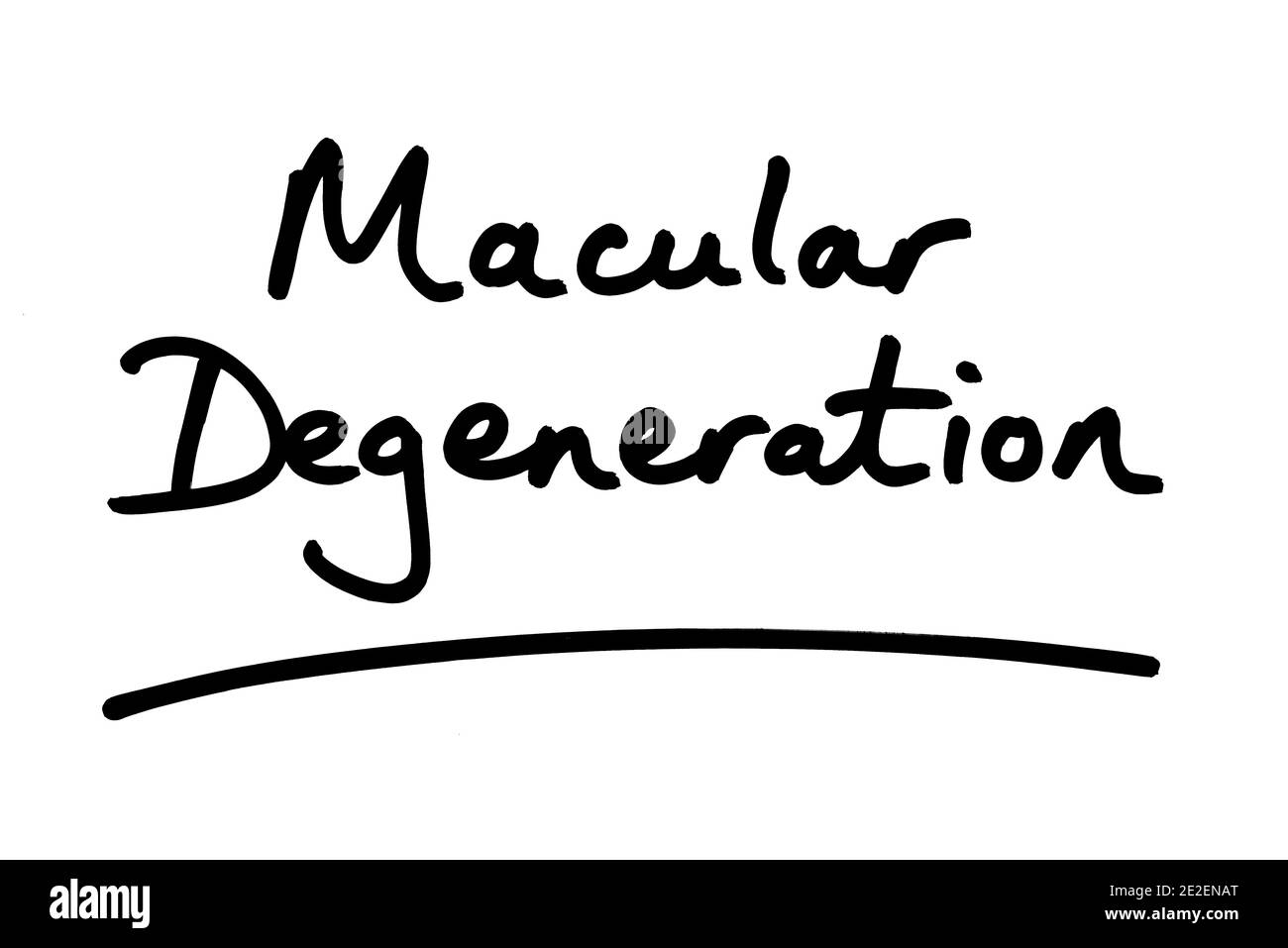 Makuladegeneration, handgeschrieben auf weißem Hintergrund. Stockfoto