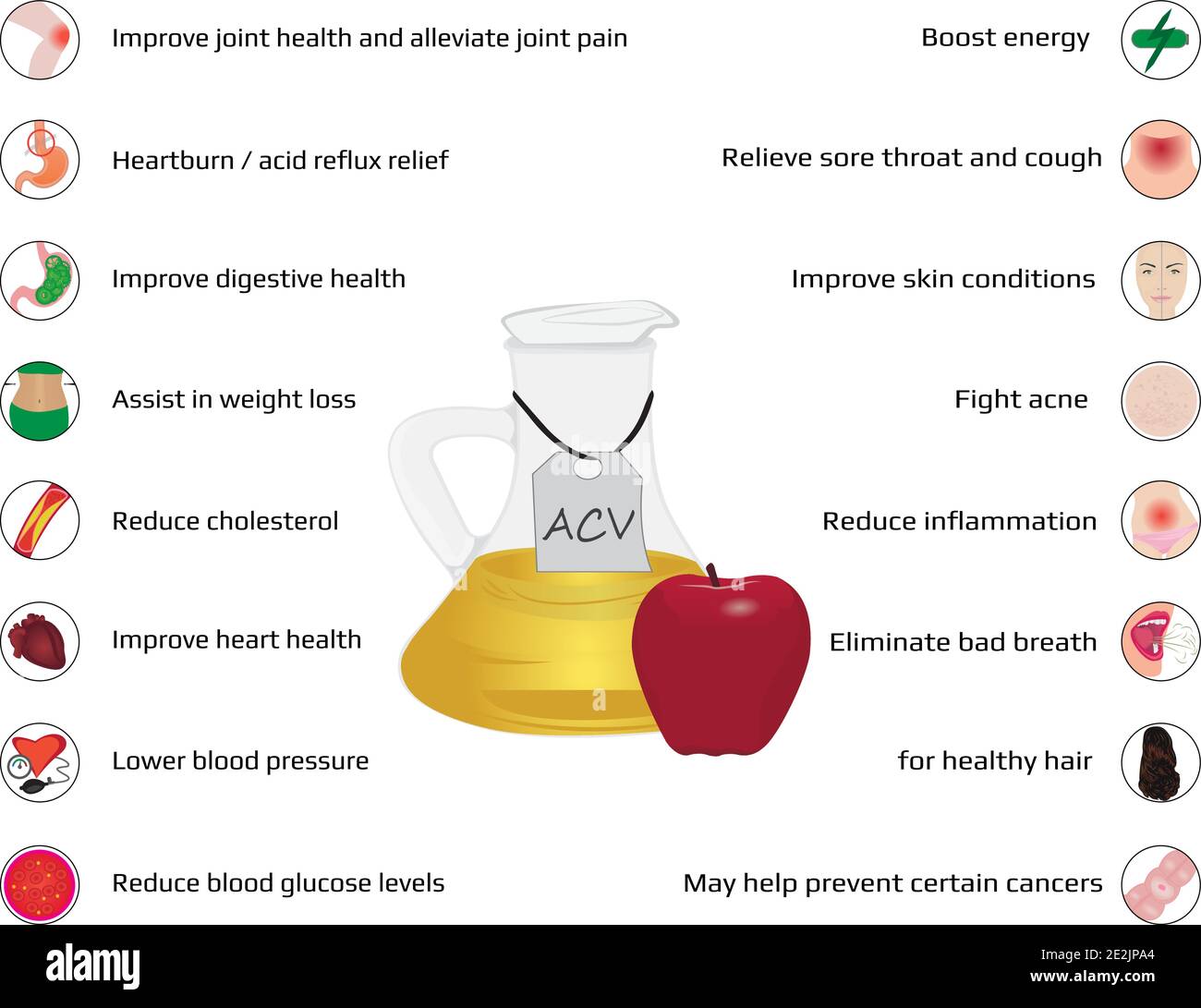 Infografiken zu ACV-Vorteilen Stock Vektor