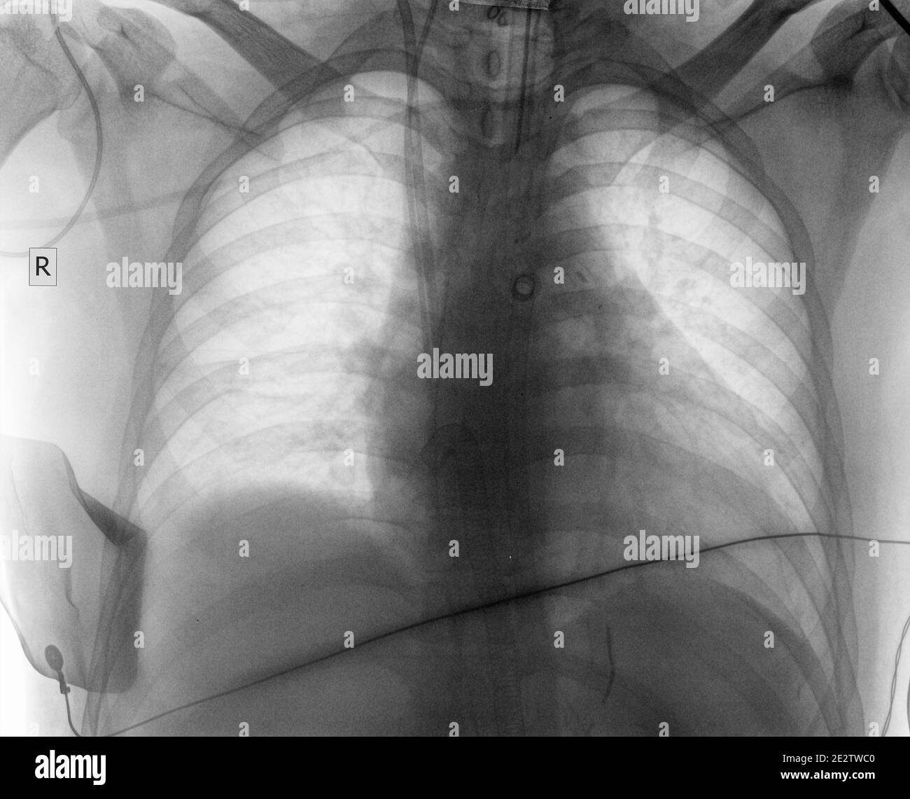 Medizinisches Röntgenbild des Patienten für Ihren wissenschaftlichen Hintergrund. Stockfoto