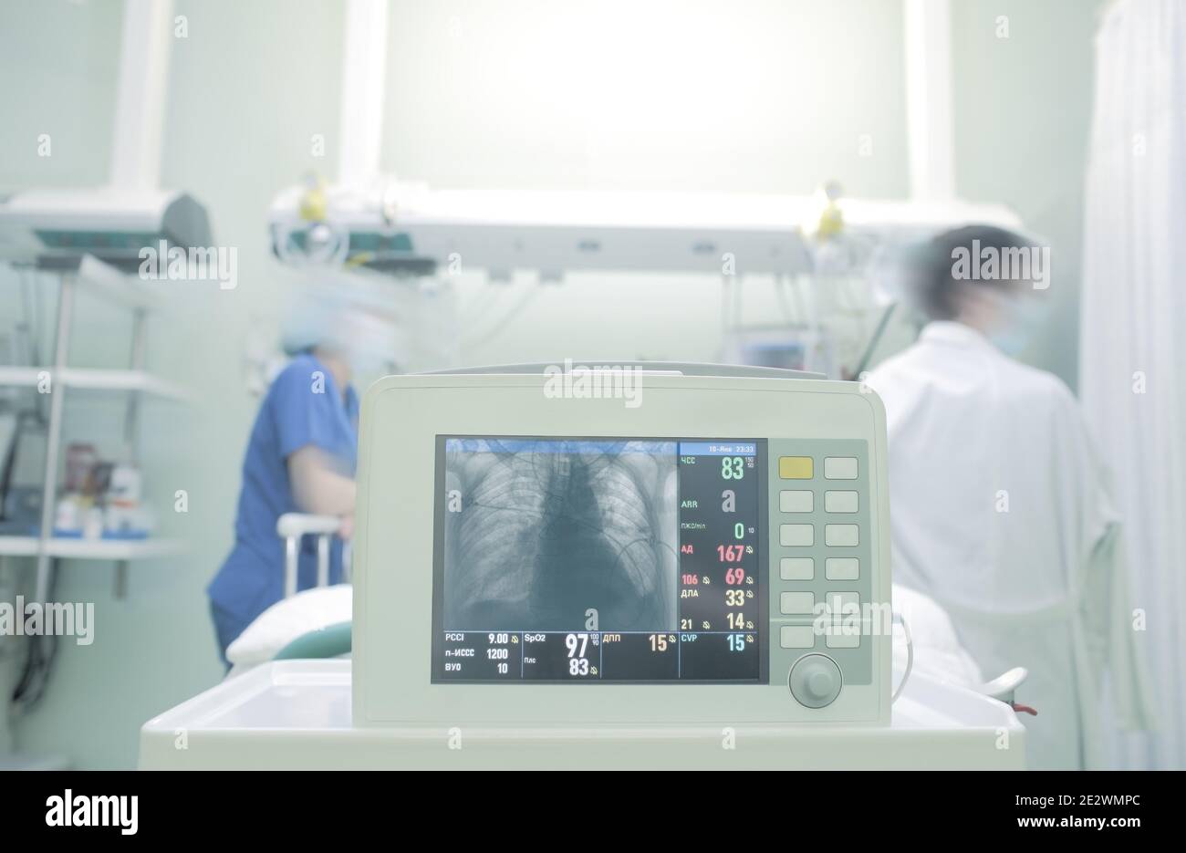 Röntgenuntersuchung der Lunge des Patienten auf der Intensivstation. Stockfoto
