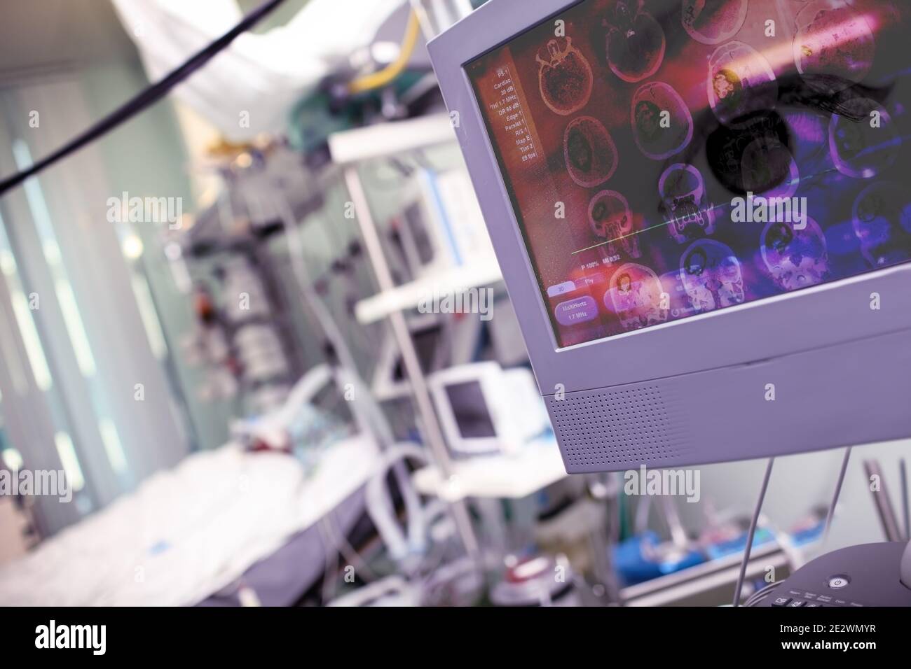 Konzept der modernen technischen Ausrüstung zum Scannen geschädigtes Gehirn. Stockfoto