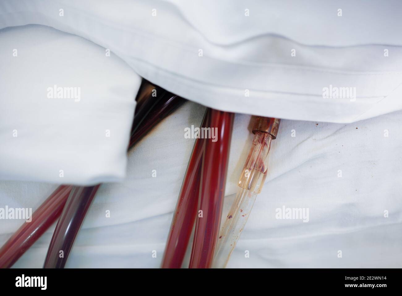 Medizinische Röhrchen gefüllt mit Blut des Patienten. Stockfoto