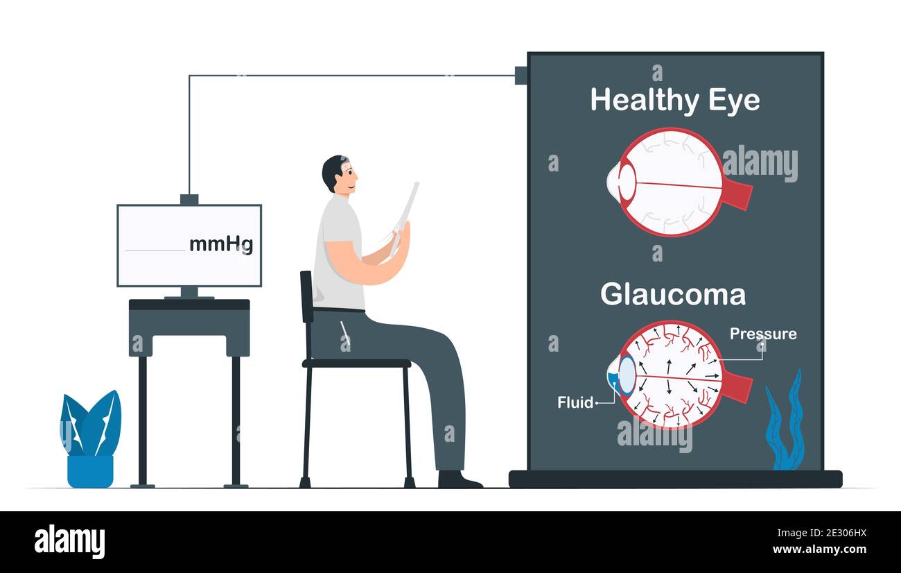 Vergleich der Gesundheit Auge und Glaukom. Arzt diagnostiziert Krankheitssymptome. Illustrierter Vektor isoliert auf weißem Hintergrund. Stock Vektor