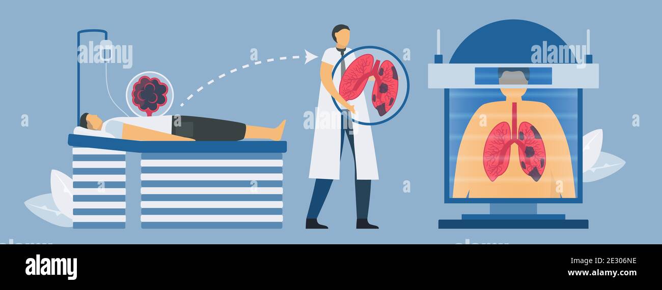 CT-Scanning-Systeme für die Untersuchung chronisch obstruktiver Lungenerkrankungen. Pneumologie Vektorgrafik. Stock Vektor