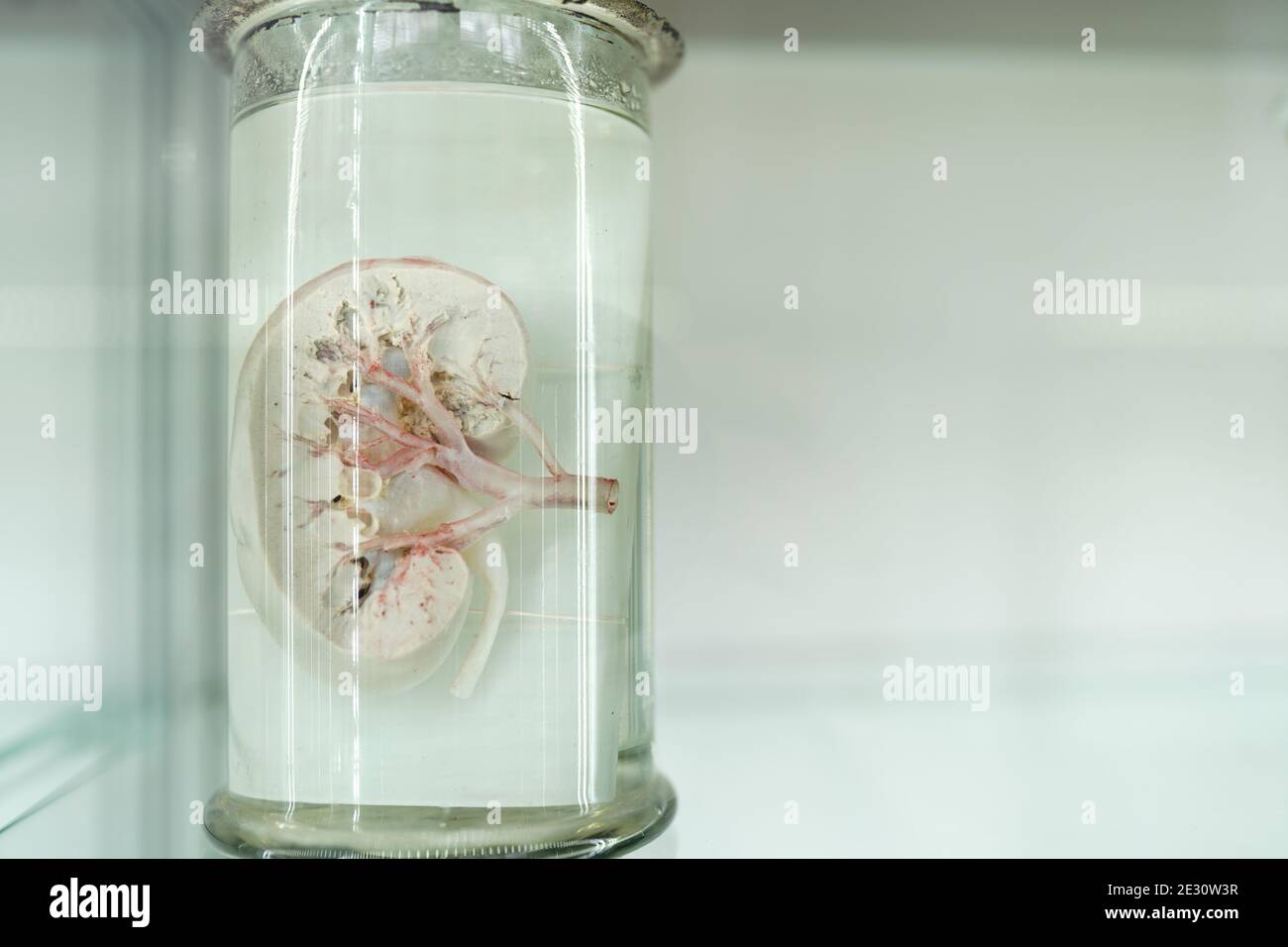 Menschliches Organ im anatomischen Museum. Blauer Hintergrund mit Kopierraum Stockfoto