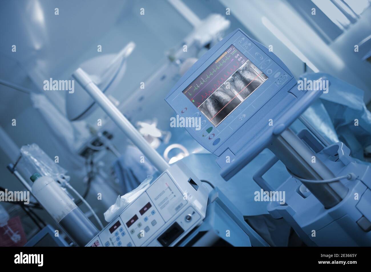 Herzfrequenz des Patienten und Röntgenaufzeichnung während der Operation. Stockfoto
