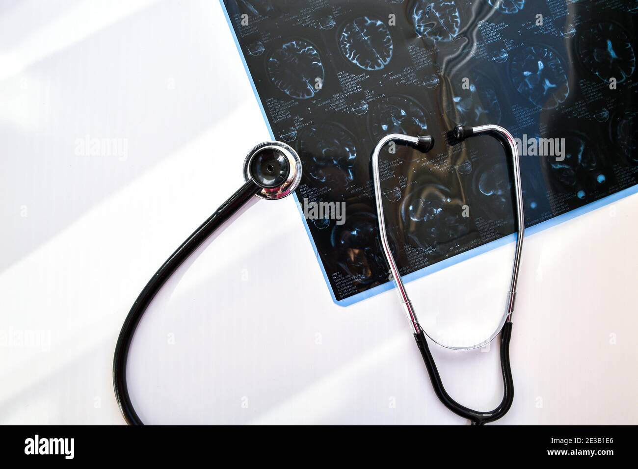 MRT in der medizinischen Praxis. MRT des menschlichen Kopfes in der Klinik mit Stethoskop. Draufsicht auf den Tisch des Arztes Stockfoto