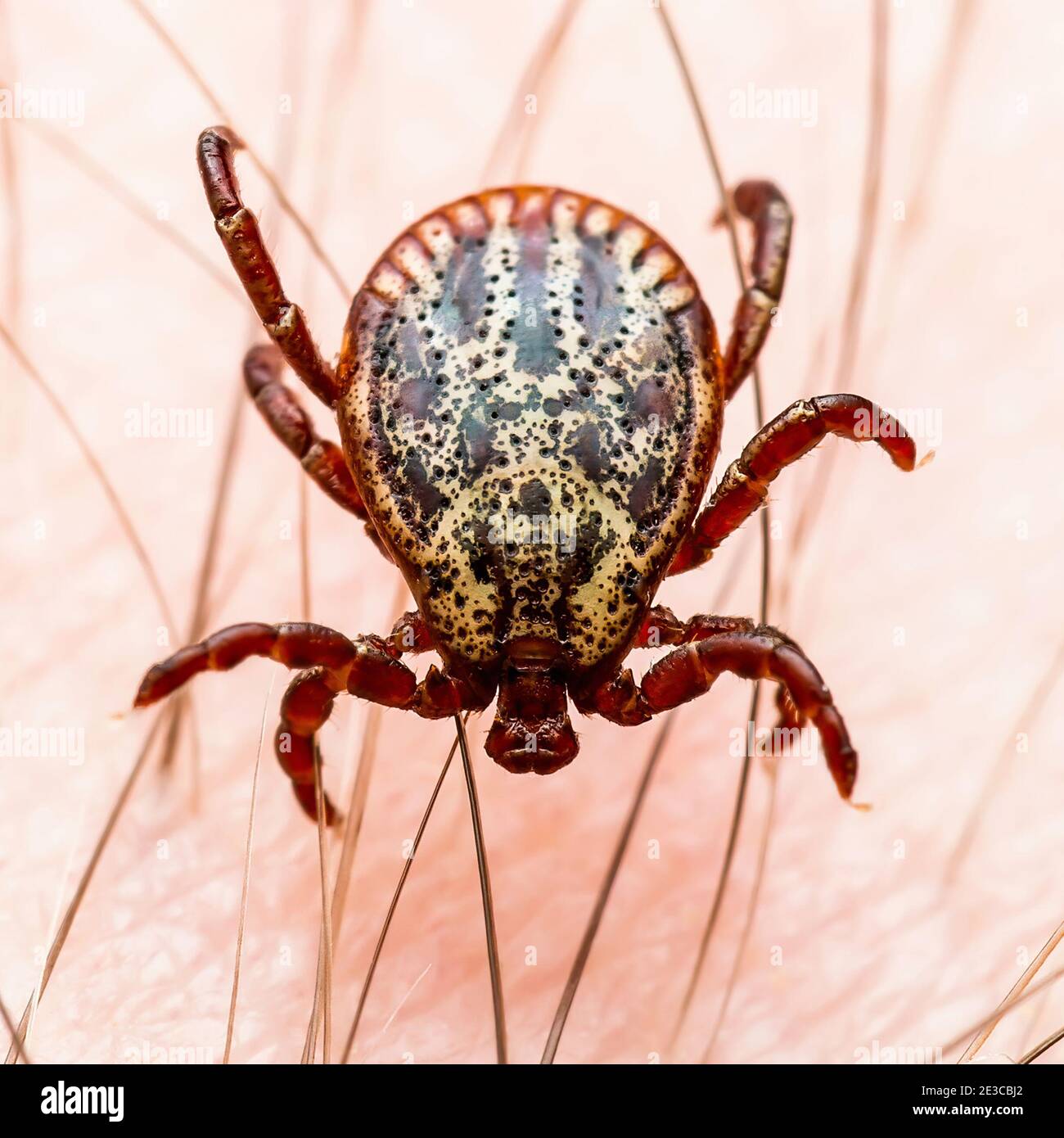 Infektiöse Enzephalitis Tick Insekt auf der Haut. Enzephalitis Virus oder Lyme-Borreliose infizierte Dermacentor Tick Arachnid Parasiten Makro. Stockfoto