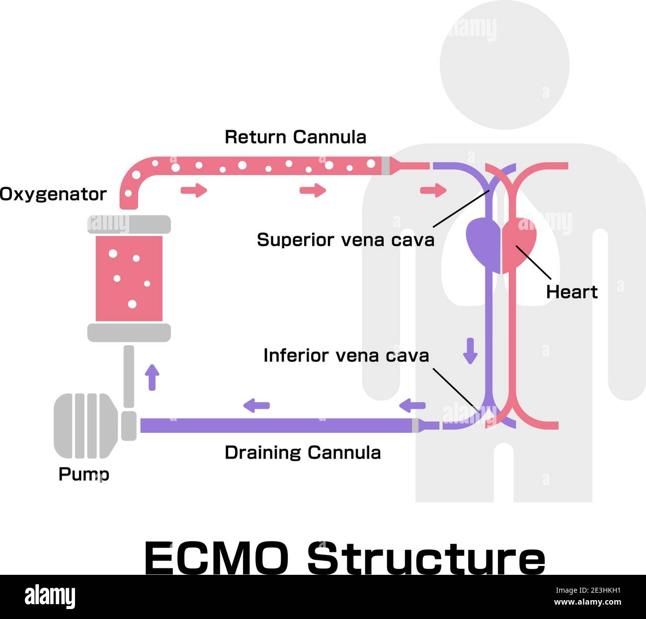 ECMO (extrakorporale Membranoxygenierung) Strukturvektordarstellung Stock Vektor