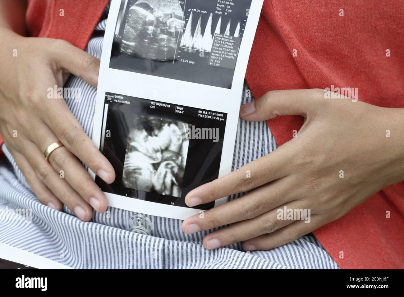 Eine schwangere Frau, die einen Ultraschallausdruck hält, der das Baby in ihrem Gebärmutterleib zeigt Stockfoto