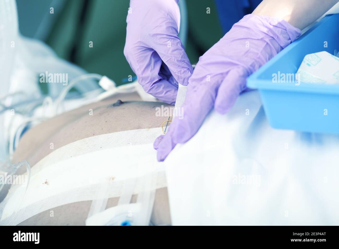 Der Arzt wechselt nach der Operation die Bandagen an den Patienten. Stockfoto