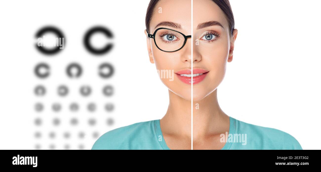 Weibliches Gesicht, halbiert, um vor und nach der Laser-Sehkorrektur zu präsentieren. Frau Gesicht mit Brille und ohne Brille, auf dem Hintergrund virtuelle Holog Stockfoto