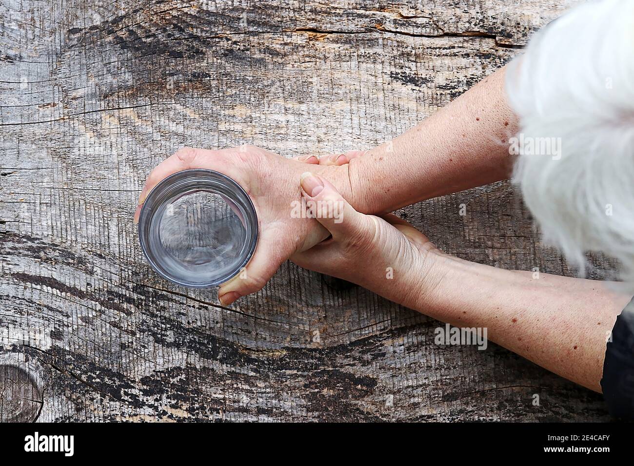 Eine Frau mit Parkinson hat sehr starke zitternde Hände Stockfoto