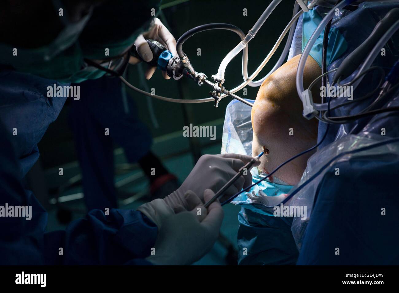 Fokussierter orthopädischer Chirurg, der mit einem Mitarbeiter auf der Intensivstation operiert Stockfoto