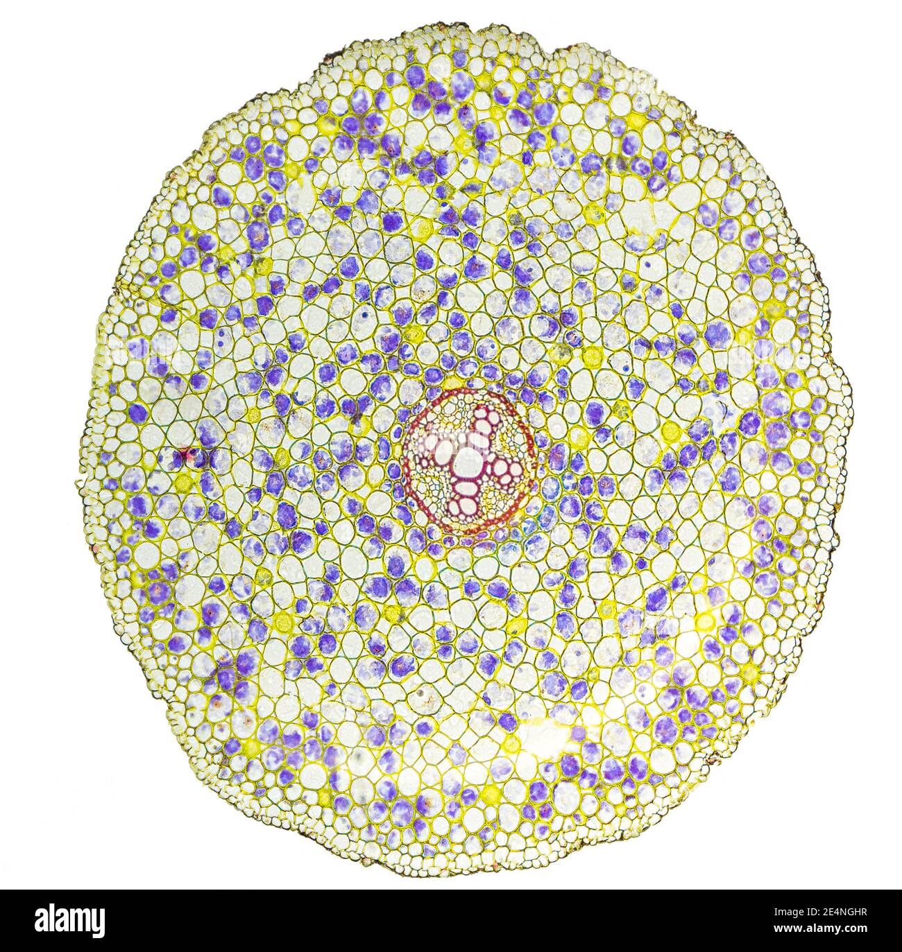 Ranunculus root t.s. metaxylem x100 Stockfoto
