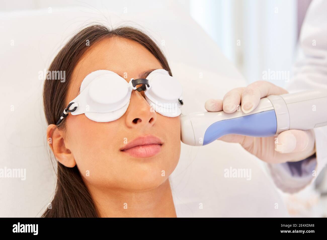 Frau als Patientin mit Hautkontakt mit einem Laser Beim Dermatologen Stockfoto