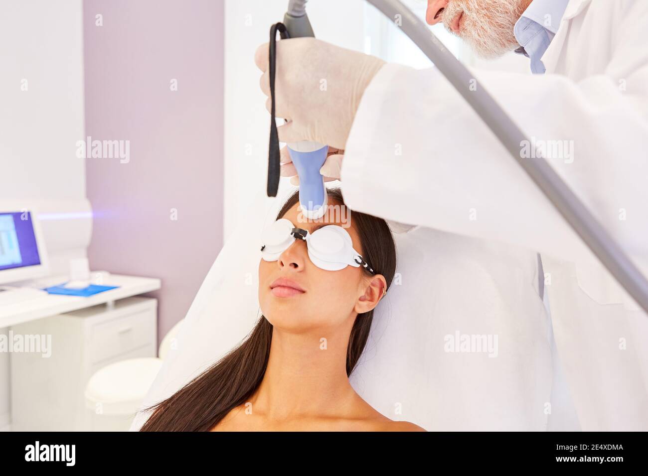 Junge Frau mit Hautverjüngung auf der Stirn durch Laser Therapie mit einem fraktionalen Laser Stockfoto