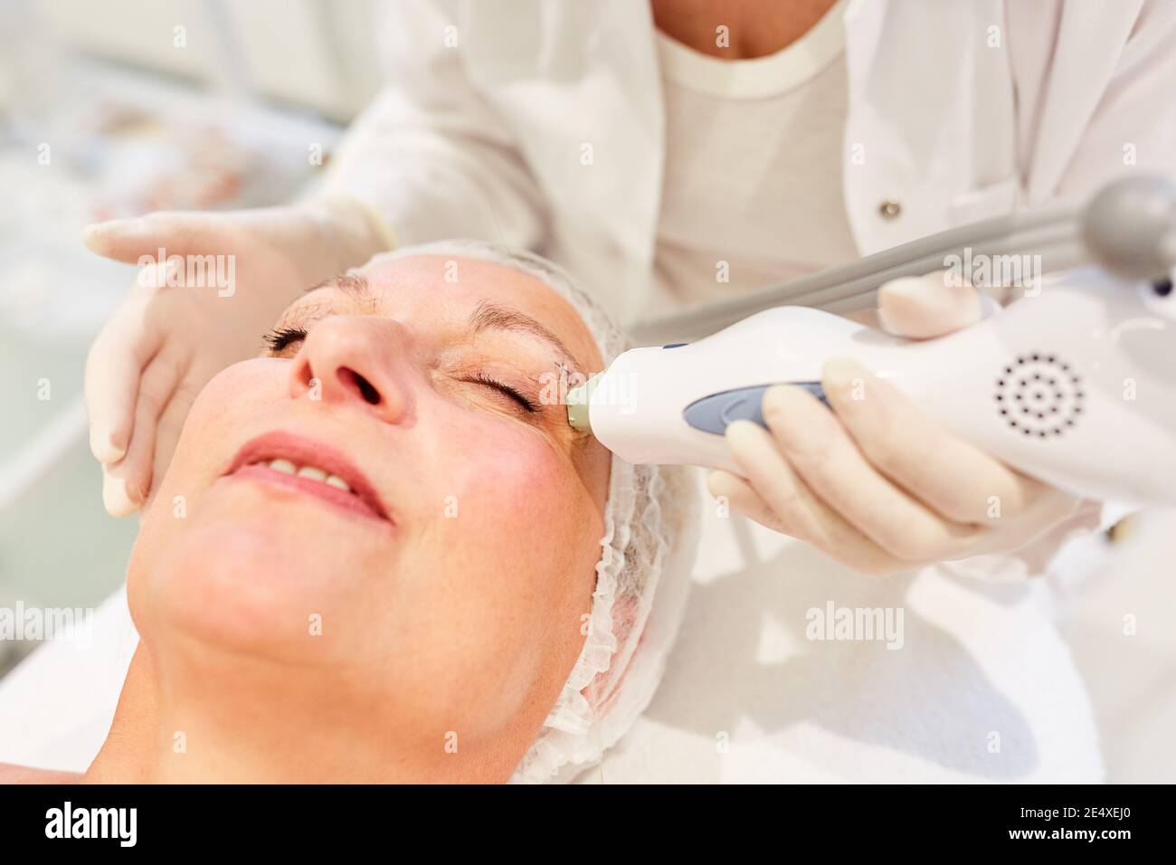 Ältere Frau mit einer Augenlid Korrektur mit Thermage Behandlung mit Radiowellen Stockfoto