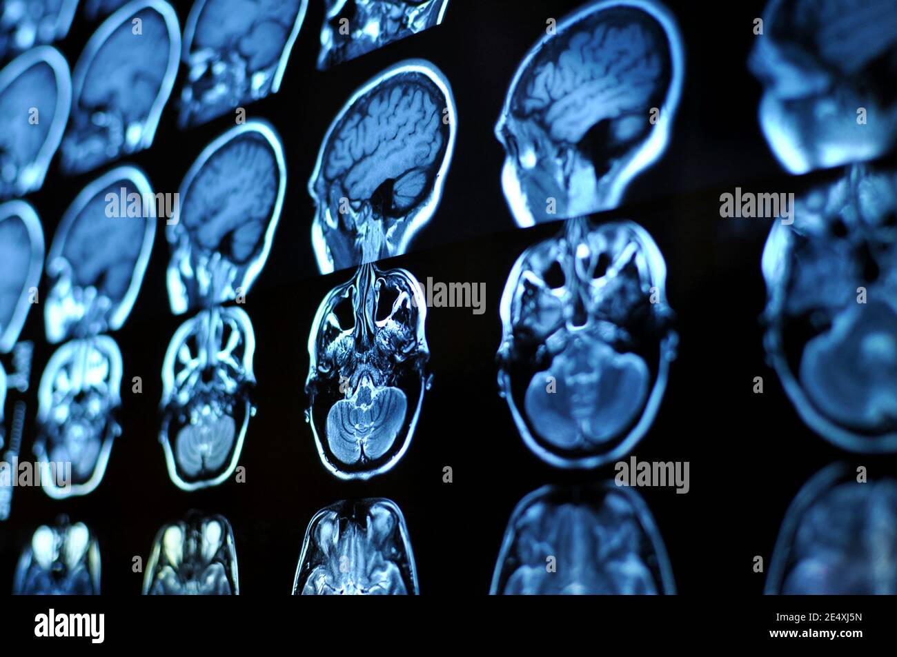 Magnetic Resonance Image Scan des Gehirns. Mrt-Film von einem menschlichen Schädel und Gehirn. Neurologie Hintergrund. Medizin, Wissenschaft, Seitenansicht Stockfoto