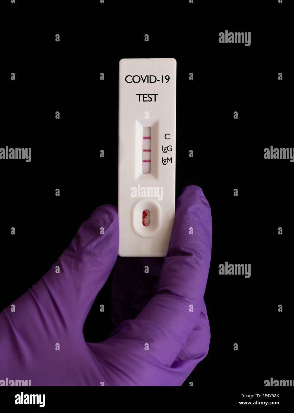 Positiver schneller serologischer Test (IgG/IgM-Antikörper) Für COVID-19 (SARS-CoV-2), die von einem Arzt mit violetten Handschuhen gehalten wird Stockfoto