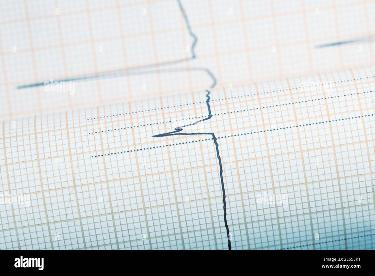 Komplexe EKG-Linie auf dem Plotting-Papier. Stockfoto