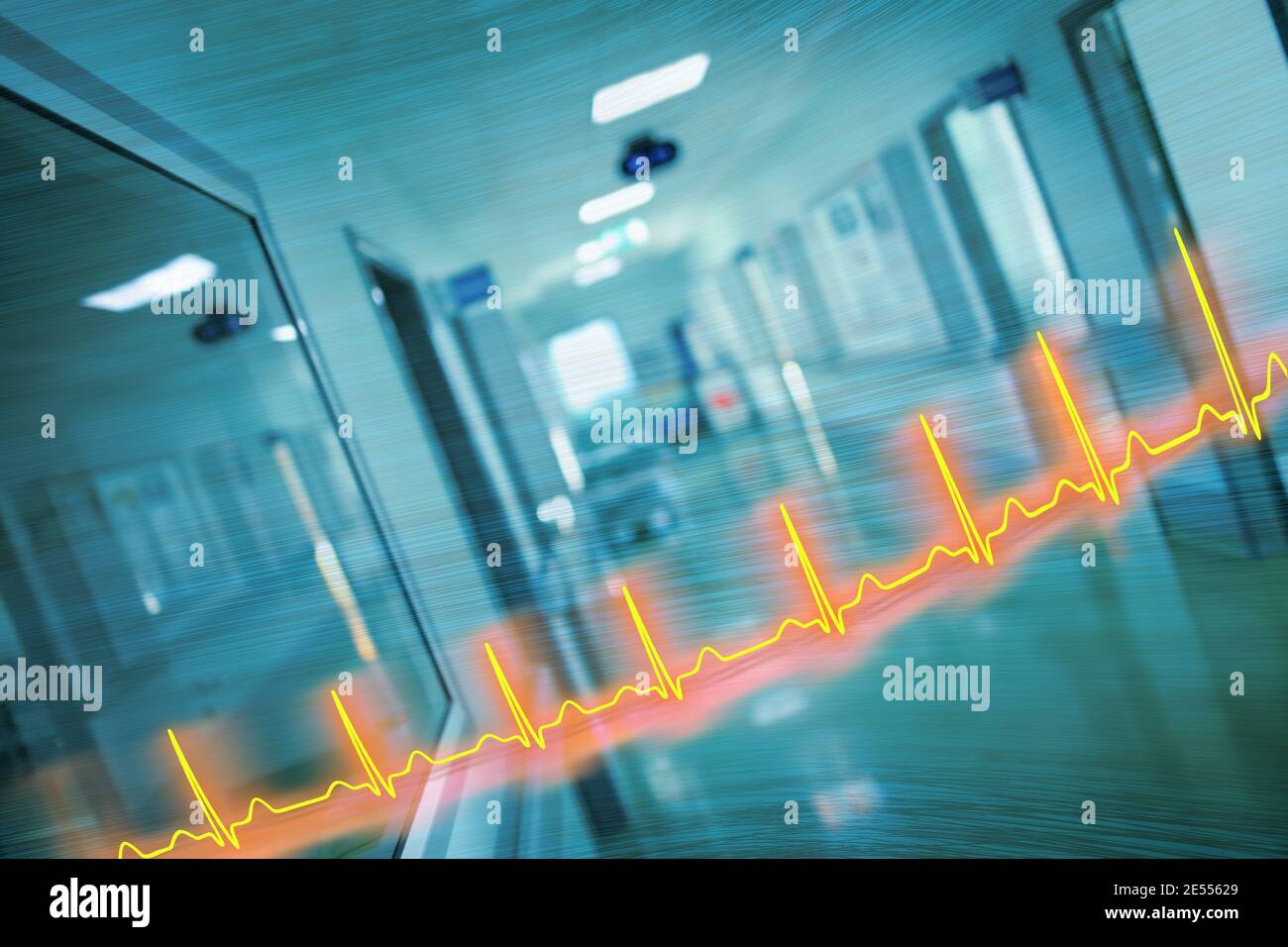 EKG-Leitung und Krankenhauskorridor, Konzept einer Notfallversorgung. Stockfoto