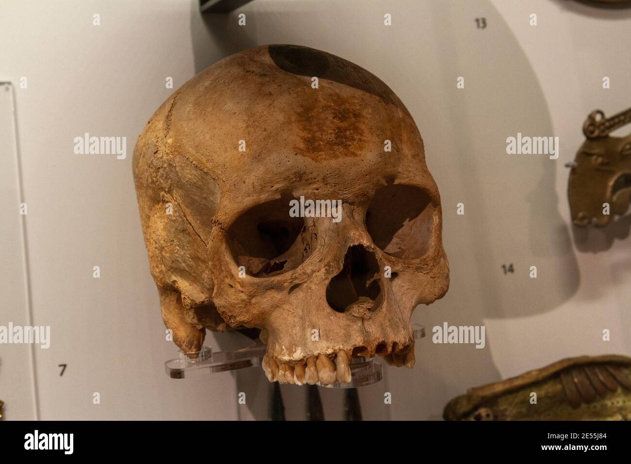 Schädel eines Männchens (25-35) in einem Warrior Grave gefunden 425-401 v. Chr., Ashmolean Museum, das Museum für Kunst und Archäologie der Universität Oxford, Oxford UK. Stockfoto