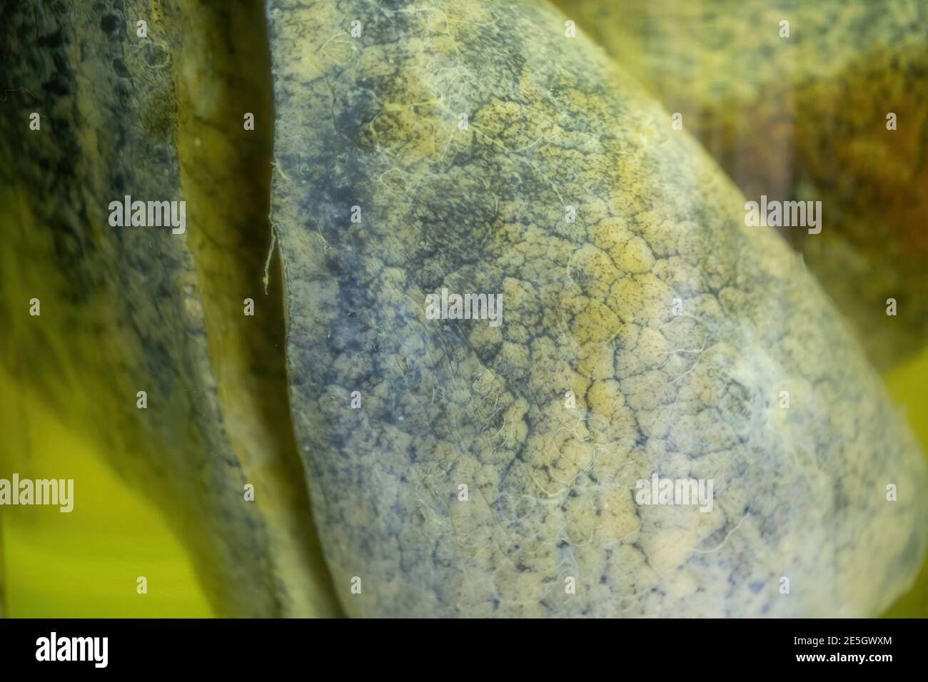 Konzept der medizinischen Problem durch Luftverschmutzung und Rauchen verursacht. Stockfoto