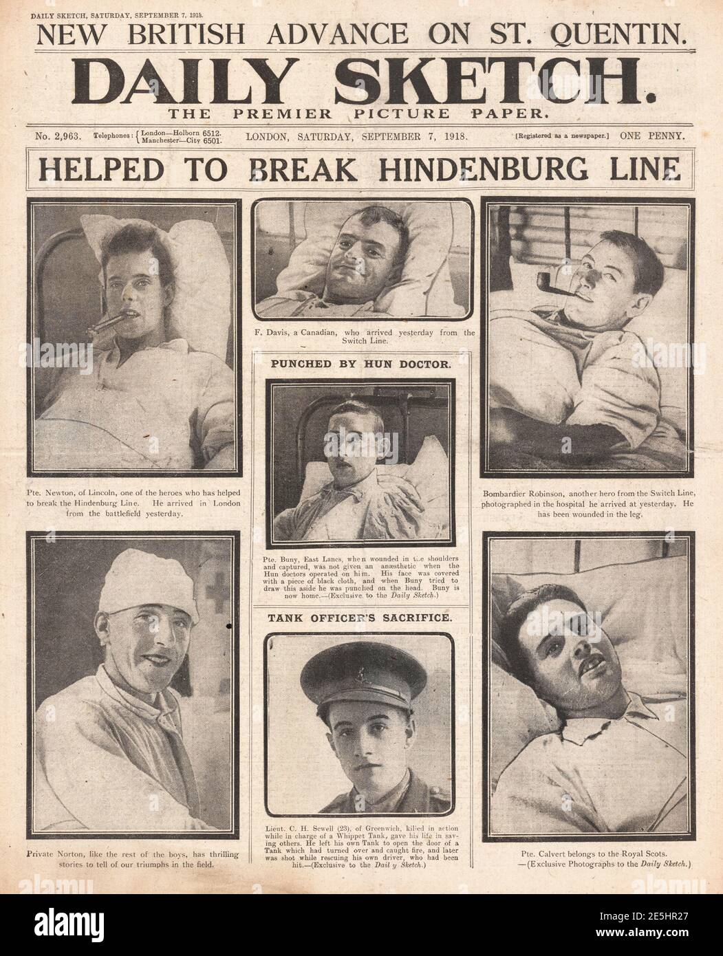 1918 Daily Sketch verwundete britische Soldaten im Krankenhaus Stockfoto