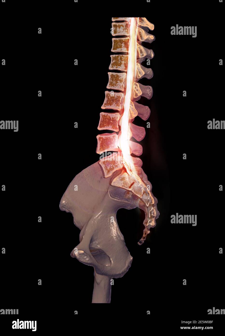 CT Lendenwirbelsäule oder L-S Wirbelsäule 3D-Rendering-Bild sagittale Ansicht 3D-Rendering . Stockfoto