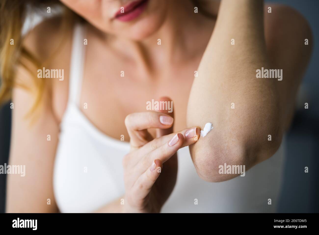 Anwendung Creme Auf Gesunde Trockene Haut Hand Stockfoto