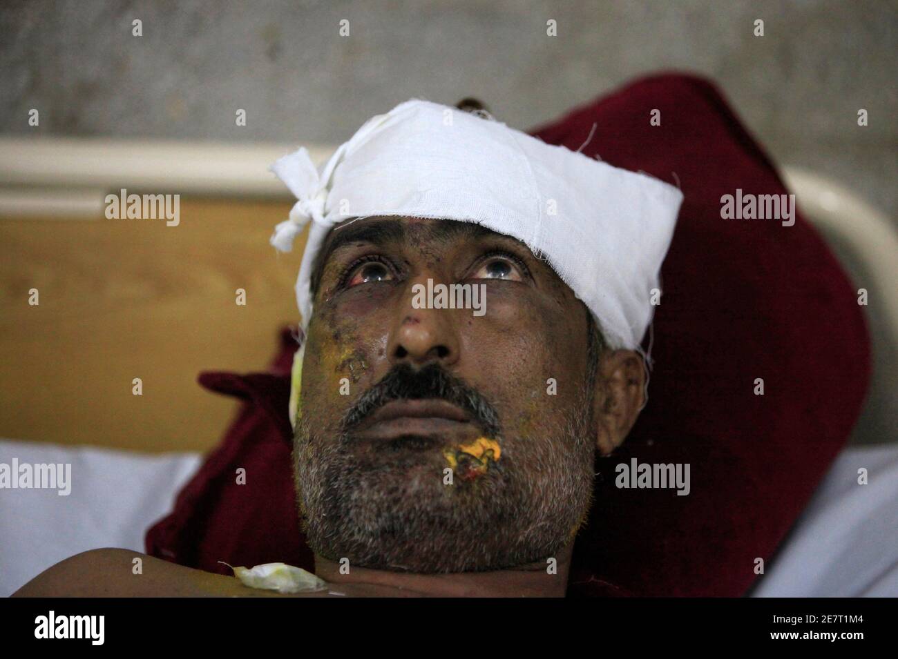 Ein Mann verletzt von einer Bombenexplosion in einer Shi'ite-Moschee ist in einem Krankenhaus in Sargodha, in der pakistanischen Provinz Punjab 19. Juli 2010 behandelt. Mindestens 15 Menschen wurden am Sonntag, den mutmaßlichen Selbstmordanschlag auf ein religiöses Zentrum der Minderheit Shi'ite Muslime in zentralen Pakistan verletzt Polizei sagte. Lokale Medien berichteten drei bei einem Bombenanschlag getötet. REUTERS/Faisal Mahmood (PAKISTAN - Tags: Unruhen Politik Kriminalität Gesetz) Stockfoto