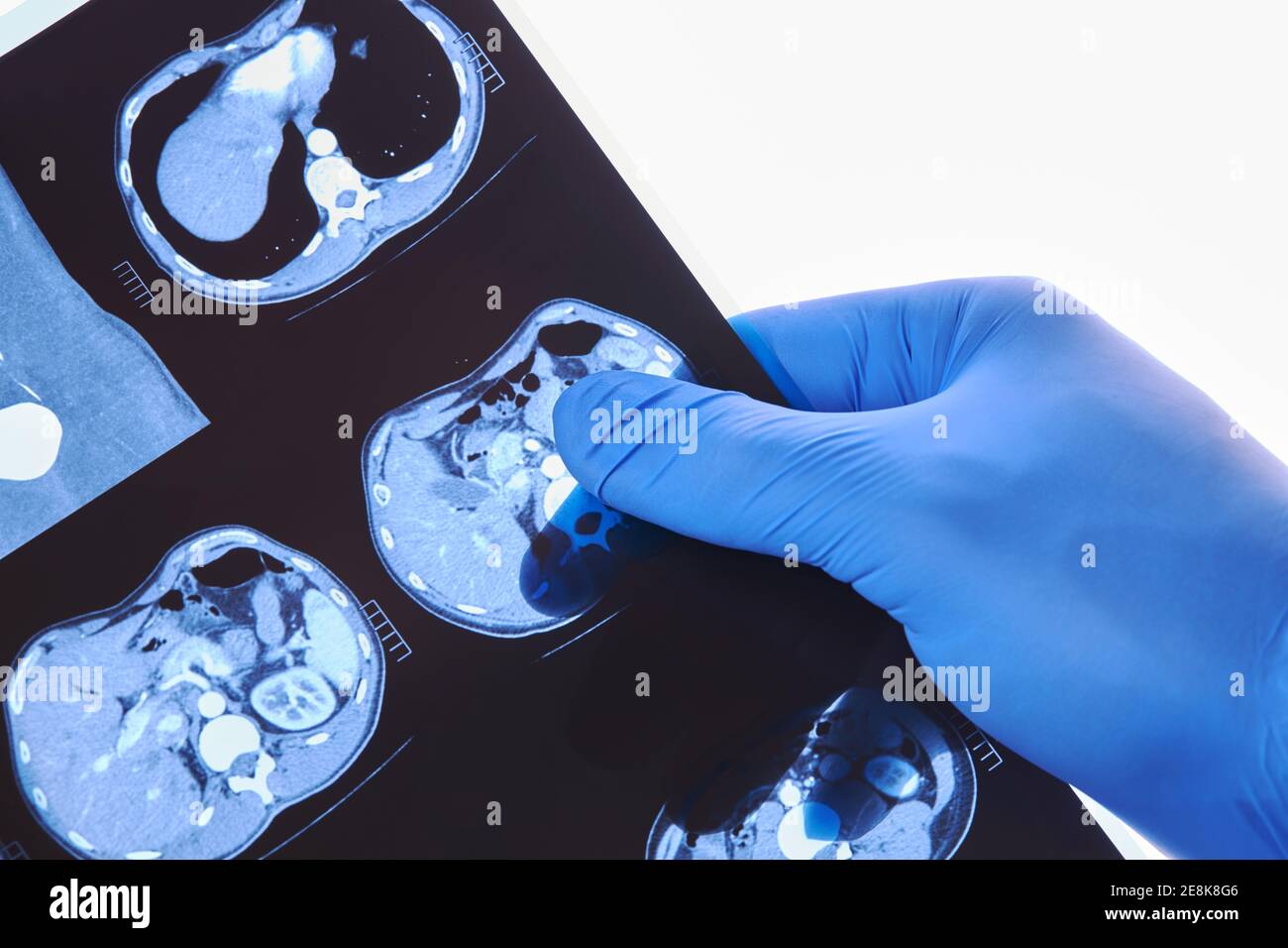Medizinische Tomographie CT Ergebnisse Untersuchung Nahaufnahme. momentaufnahme der inneren Organe. Medizinische Untersuchung Stockfoto
