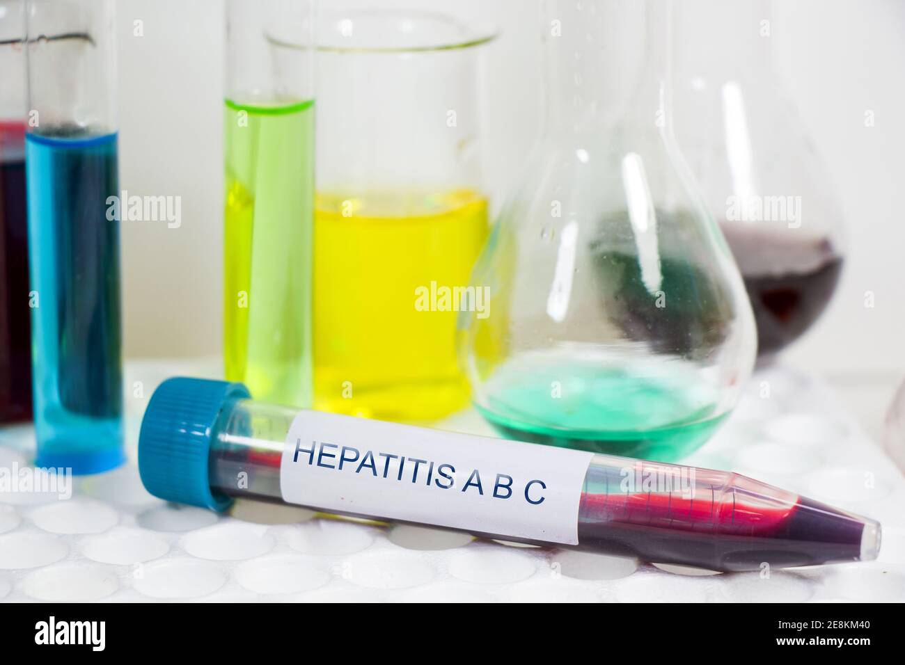 Eine Nahaufnahme eines Hepatitis-Bluttests auf einer bunten Flüssigkeit Hintergrund für chemische Elemente Stockfoto