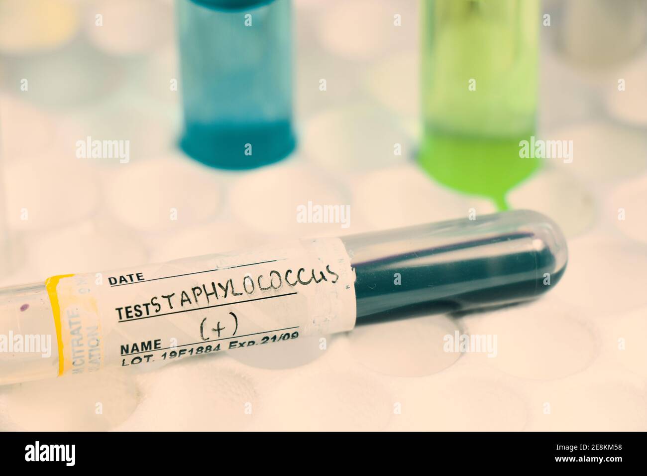 Nahaufnahme eines Staphylokokken-Tests auf dem Labortisch Stockfoto