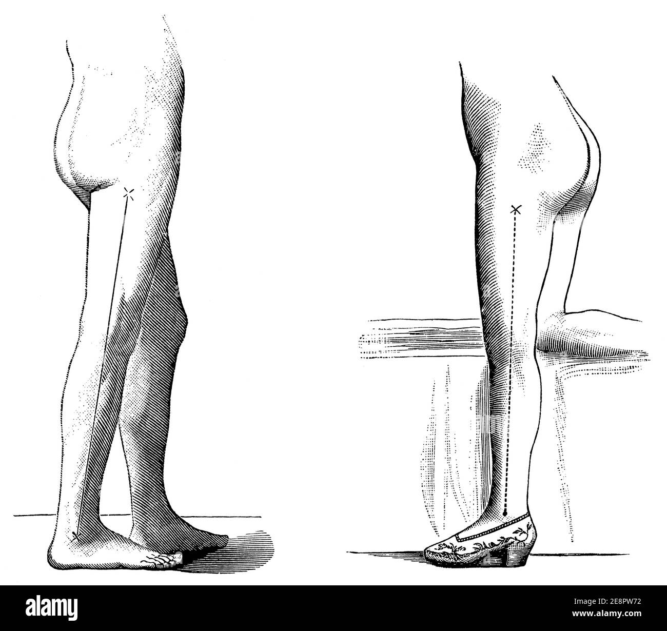 Beispiele für die Position der Füße einer Person mit und ohne Schuhe. Illustration des 19. Jahrhunderts. Deutschland. Weißer Hintergrund. Stockfoto