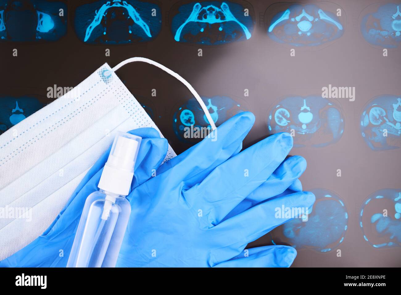 Medizinische Tomographie CT Ergebnisse mit medizinischen Gesichtsmaske und blauen Latexhandschuhe. Copy space Stockfoto
