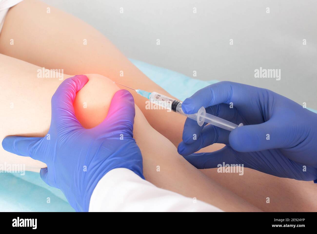 Der Arzt injiziert Injektionen mit Hyaluronsäure in das Kniegelenk eines  Patienten mit Schmerzen und Arthrose im Knie. Konzept der gemeinsamen  Behandlung Stockfotografie - Alamy