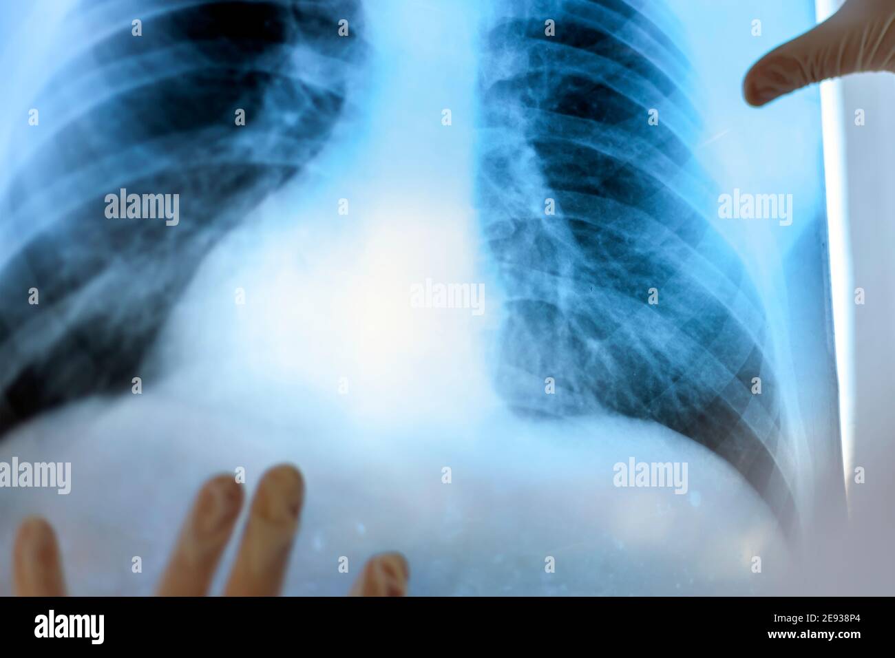 Eine Pneumologin hält eine Lungenscan in ihren Händen. Stockfoto