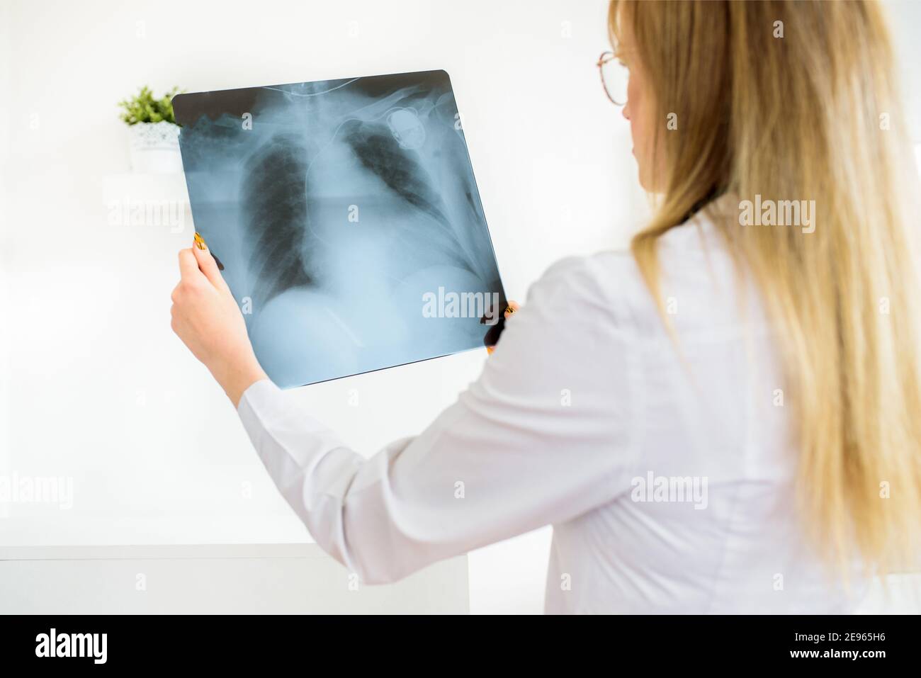 Attraktive Ärztin im weißen Mantel, mit einem Stethoskop am Hals hält einen Röntgenstrahl in den Händen, hält viele Röntgenaufnahmen in Betracht.Untersuchung von Patienten Stockfoto