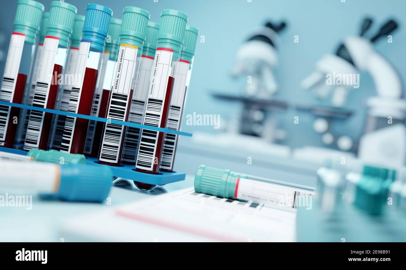 Blutproben in einer Testeinrichtung. Medizinische Forschungslabor Hintergrund. 3D Abbildung. Stockfoto