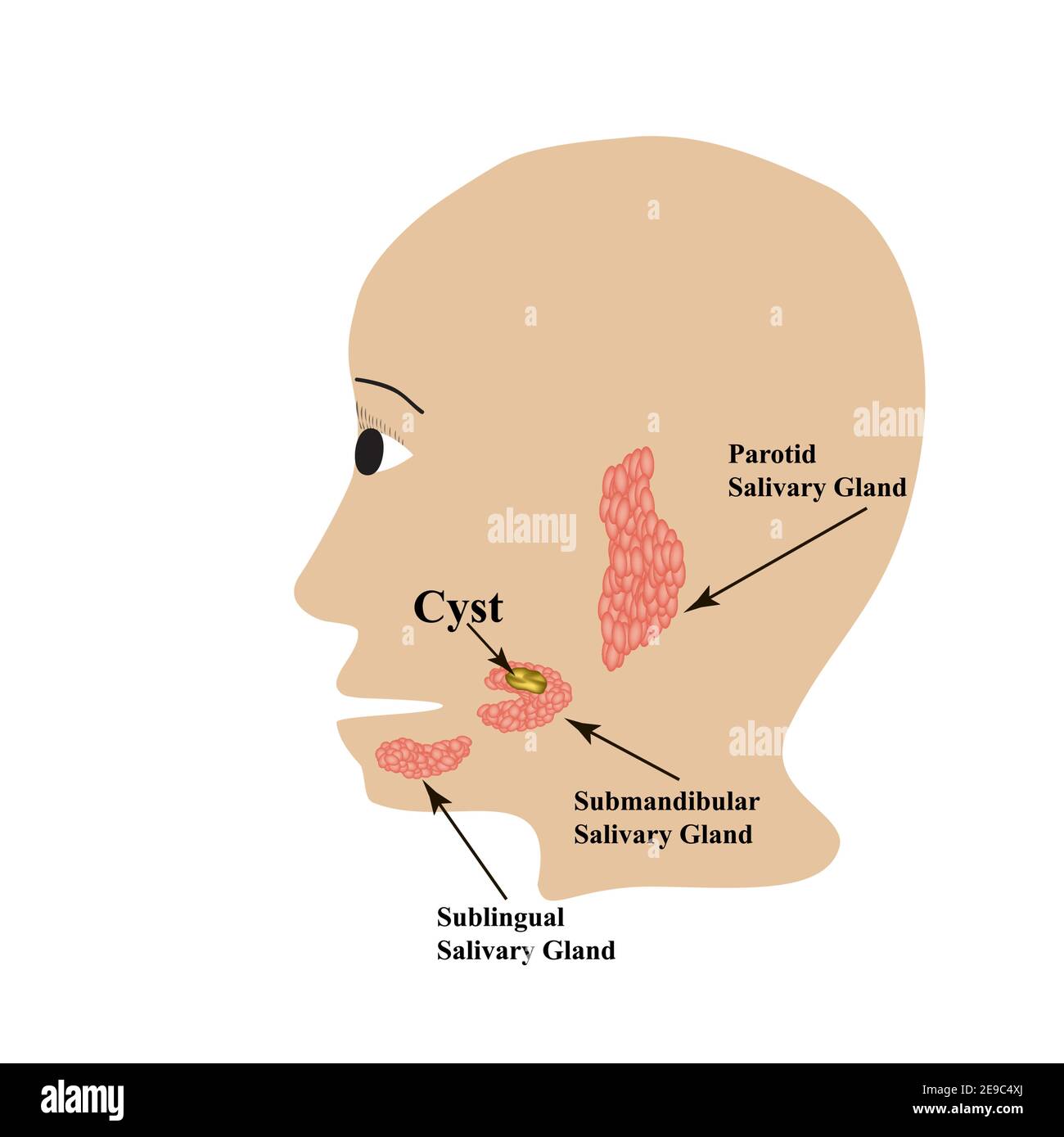 Speicheldrüse der Ohrspeicheldrüse. Speicheldrüse submandibulär.  Sublinguale Speicheldrüse. Zyste. Vektorgrafik auf isoliertem Hintergrund  Stock-Vektorgrafik - Alamy