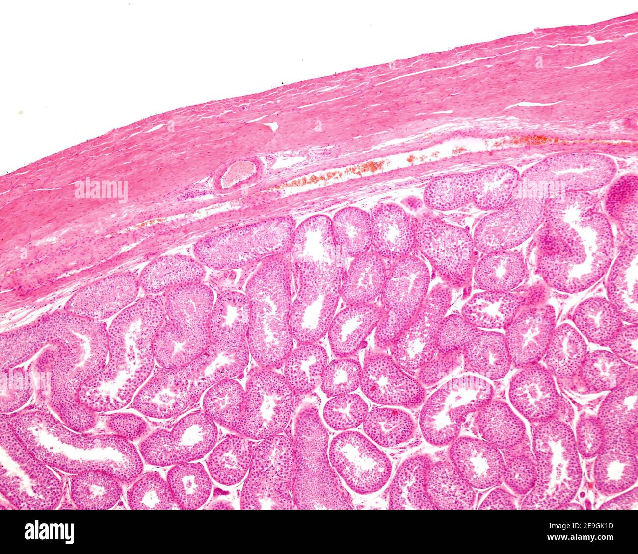 Mikroskop-Lichtmikroskop-Mikrograph, der die Tunica alboginea eines menschlichen Hoden zeigt. Unterhalb der äußeren Faserschicht befindet sich die Tunica vasculosa und das Seminif Stockfoto